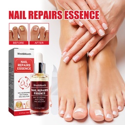 Essence Tái Tạo Móng Tay West&Month, Sửa Chữa Móng Tay Xám, Móng Tay Sáng, Móng Tay Mềm, Giải Pháp Chăm Sóc Móng Tay Sạch