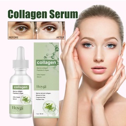 Serum Collagen Hoygi, Giảm Nhẹ Các Đường Nếp Nhăn, Cung Cấp Độ Ẩm, Săn Chắc và Chống Nhăn.