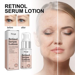Lotion Serum Retinol Hoygi, Làm mờ nếp nhăn, Cung cấp nước, Chống lão hóa, Làm săn chắc da mặt