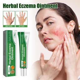 Thuốc mỡ eczema thảo dược South Moon, giảm đỏ da, ngứa và sửa chữa da tay chân